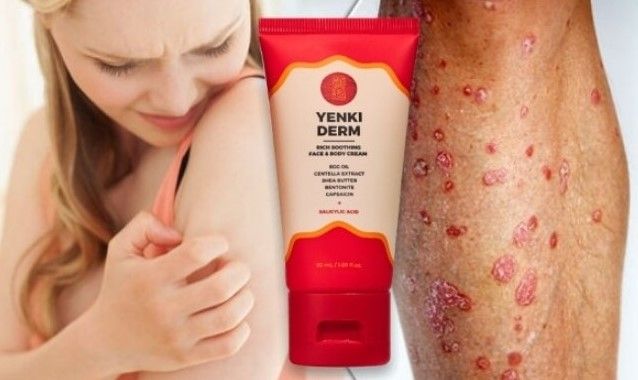 86a898a4-79ed-4a9b-9e66-fbbe0ac565ab-Yenki Derm Cream.jpg